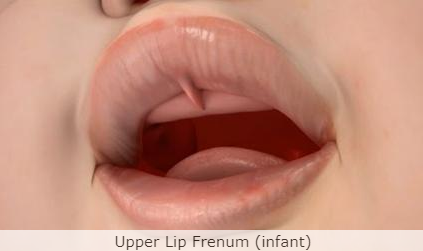 lip